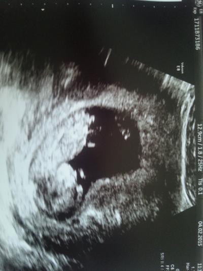 Bild zu Es ist Liebe - Forum für August - Mamis