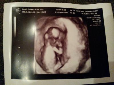 Bild zu Auch gute Nachrichten vom Arzt :-) - Forum für August - Mamis