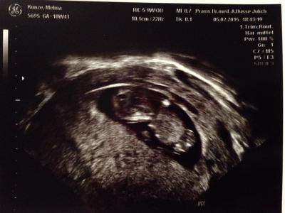 Bild zu FA-Termin heute - Forum für August - Mamis