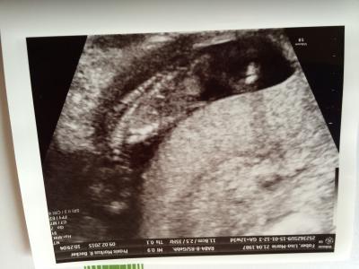 Bild zu Heute Frauenarzt Besuch der zweite - Forum für August - Mamis