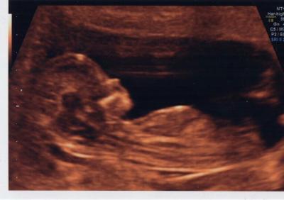 Bild zu Heutige NFM - Forum für August - Mamis