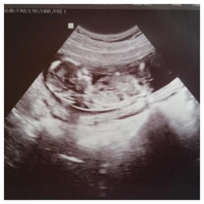 Bild zu fa Termin - Forum für August - Mamis