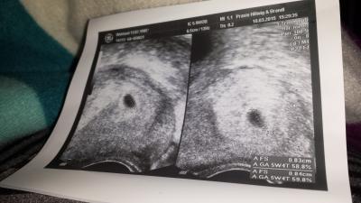 Bild zu hu hu - Forum für August - Mamis