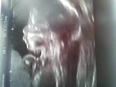 Bild zu feindiagnostik zurück. . - Forum für August - Mamis