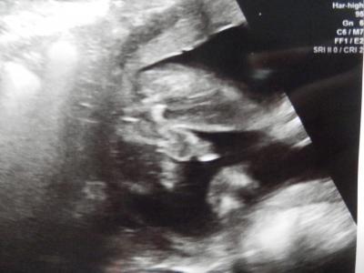 Bild zu Outing! - Forum für August - Mamis