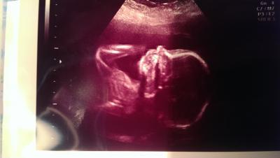 Bild zu organscreening - Forum für August - Mamis