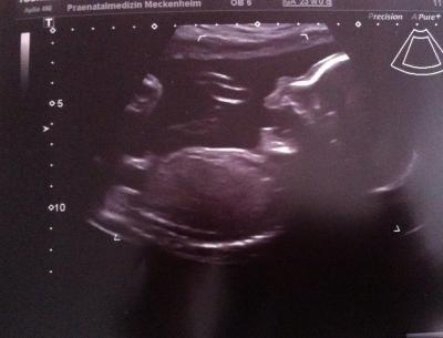 Bild zu Organscreening bei 23+0 - Forum für August - Mamis