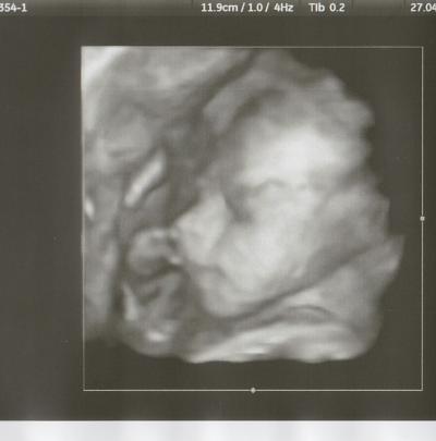 Bild zu Gestern FA-Termin :-) - Forum für August - Mamis