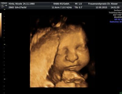 Bild zu Update Frauenarzt - Forum für August - Mamis