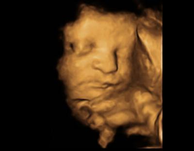 Bild zu 3.Screening - Forum für August - Mamis