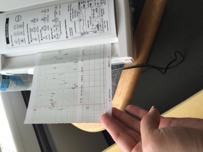 Bild zu Mein ctg von heute - Forum für August - Mamis