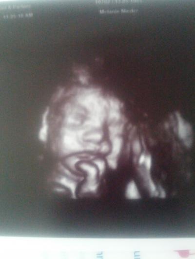 Bild zu FA Termin - Forum für August - Mamis