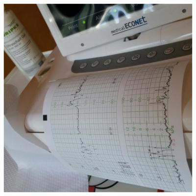 Bild zu fa Termin 3.screening - Forum für August - Mamis