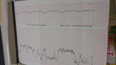 Bild zu War beim fa wegen die schmerzen - Forum für August - Mamis