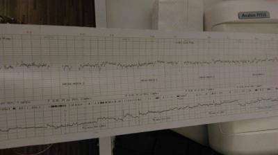Bild zu Was sagt Ihr zu diesen CTG? - Forum für August - Mamis