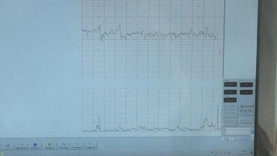 Bild zu Kurzer Bericht - Forum für August - Mamis