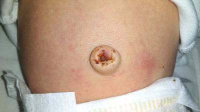 Bild zu bauchnabel - Forum für August - Mamis