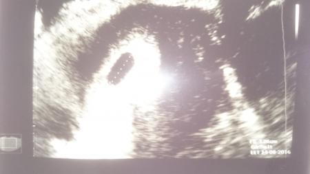 Bild zu 1. Bild nur leider eine fruchthöhle - Forum für August - Mamis