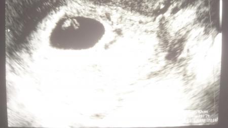Bild zu So zurück vom Baby TV - Forum für August - Mamis
