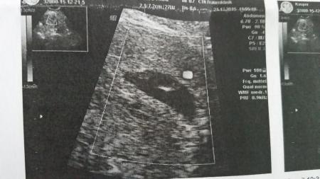 Bild zu letzte Hürde geschafft , bin glücklich ... - Forum für August - Mamis
