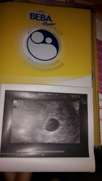 Bild zu Außerplanmäßige bei. Fa gewesen - Forum für August - Mamis