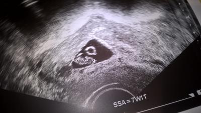 Bild zu Melde mich aus der Versenkung - heute FA Termin - Forum für August - Mamis