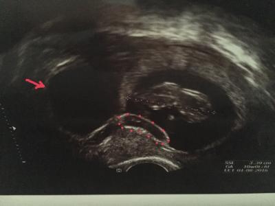 Bild zu Was ist das für ein großer Fleck auf dem US? - Forum für August - Mamis
