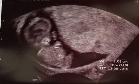 Bild zu Zurück vom FA + Bild - Forum für August - Mamis