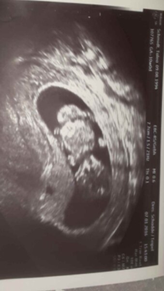 Bild zu Us bild - Forum für August - Mamis