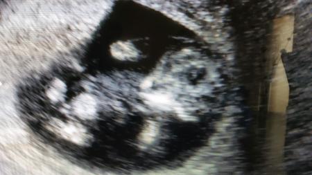 Bild zu Was meint ihr? - Forum für August - Mamis