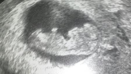 Bild zu Ich bin VERLIEBT - Forum für August - Mamis