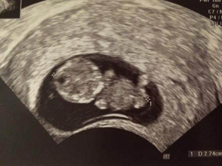 Bild zu Endlich bin ich beruhigt... Sooo schön! - Forum für August - Mamis