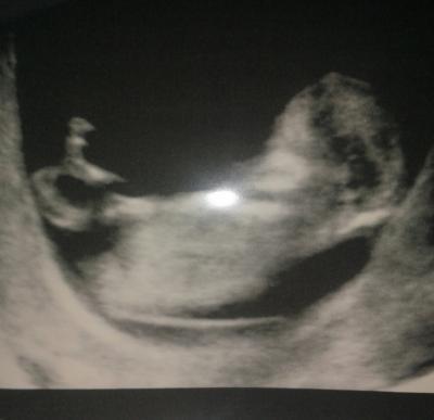Bild zu Zurück vom FA - Forum für August - Mamis