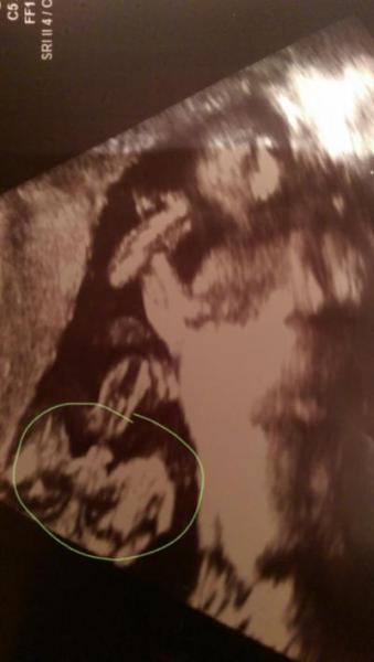 Bild zu Junge oder mädchen? - Forum für August - Mamis