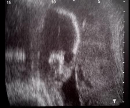 Bild zu Melde mich auch mal wieder😊 - Forum für August - Mamis