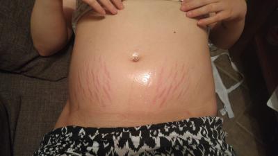 Bild zu Auskotzen - Forum für August - Mamis