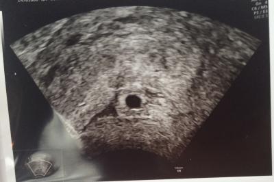 Bild zu FA Termin und wieder warten... - Forum für August - Mamis