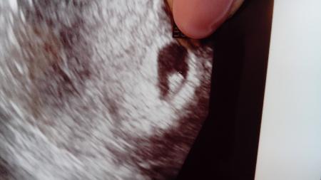 Bild zu Zurück vom Termin - Forum für August - Mamis