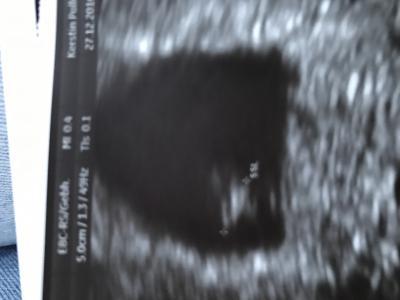 Bild zu Fa-Termin :) - Forum für August - Mamis