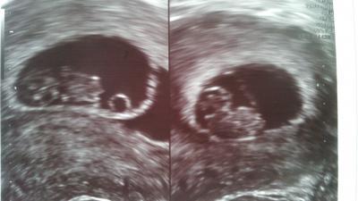 Bild zu Alles ok mit den Zwergen :) - Forum für August - Mamis