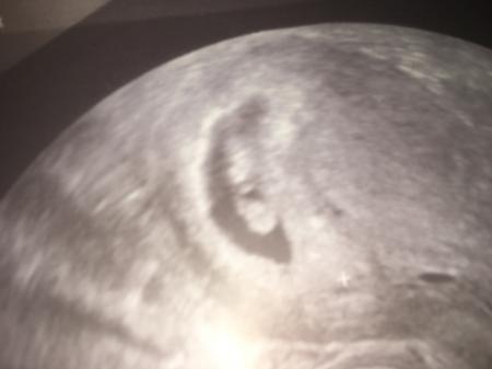 Bild zu Gestern Besuch im KH - Forum für August - Mamis