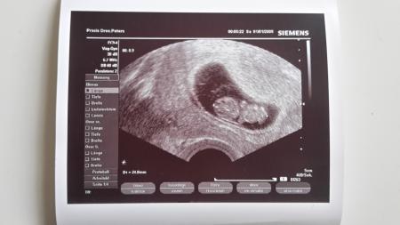 Bild zu zurück vom FA und glücklich - Forum für August - Mamis