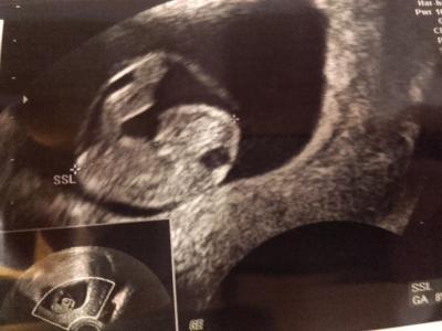 Bild zu Zurück vom FA - Forum für August - Mamis
