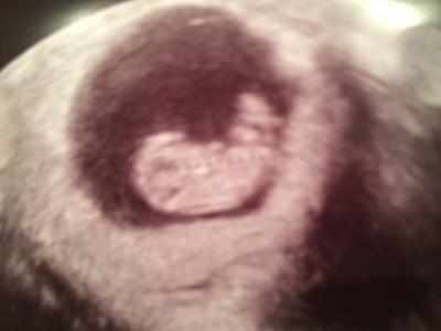 Bild zu Alles toll! - Forum für August - Mamis
