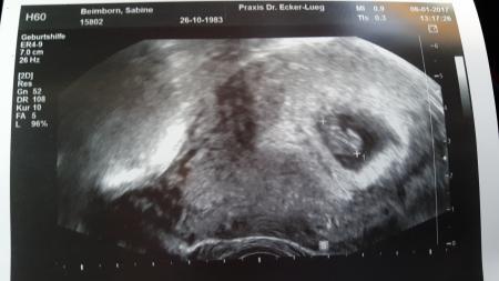 Bild zu Erster FA termin - Forum für August - Mamis