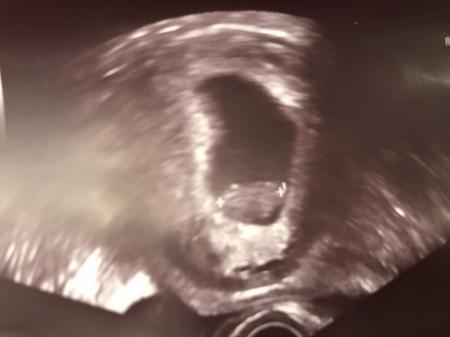 Bild zu Mein kleines Gummibärchen... - Forum für August - Mamis