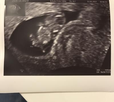 Bild zu Zurück vom fa:) - Forum für August - Mamis
