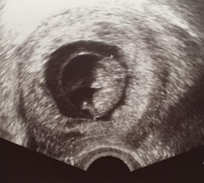 Bild zu Zurück vom Frauenarzt! Wird es ein Junge? - Forum für August - Mamis
