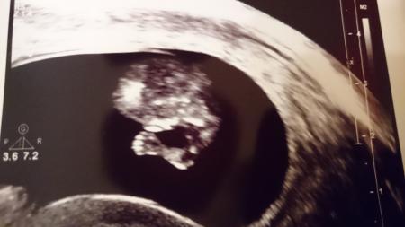 Bild zu Baby winkt und lutscht am Daumen - Forum für August - Mamis