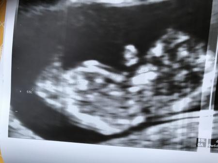 Bild zu Schon wieder da! - Forum für August - Mamis